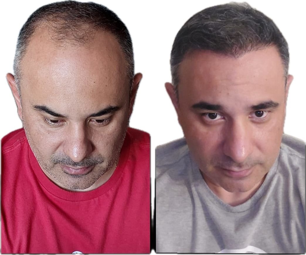 WhatsApp Image 2026-03-04 at 18.15.04